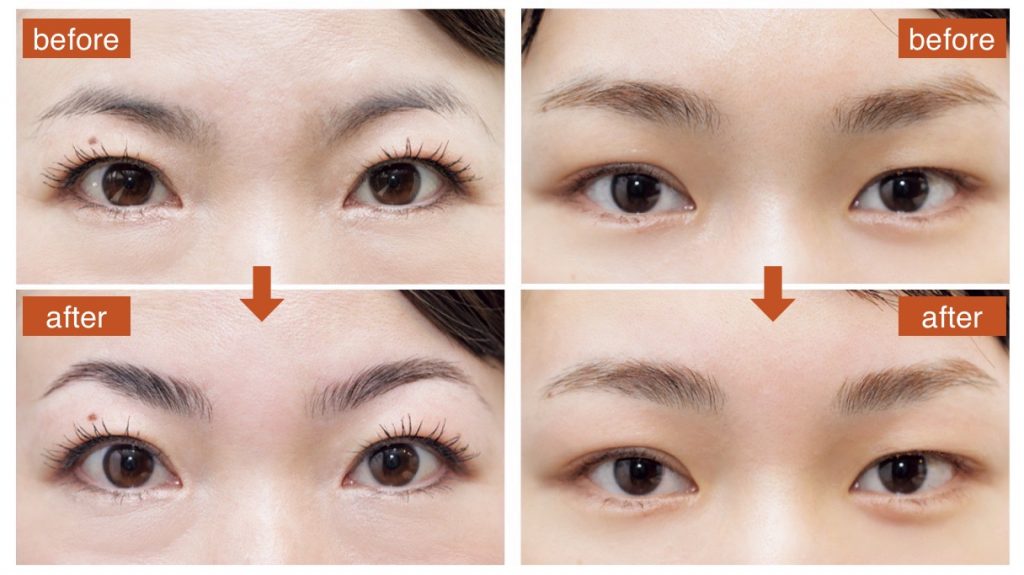 眉リフトの準備はどうすればいいですか?